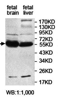 KATNA1 Rabbit Polyclonal Antibody