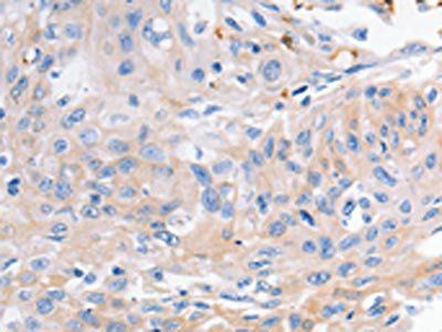 KCNA1 Antibody