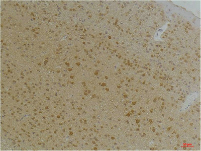 KCNA10 Antibody