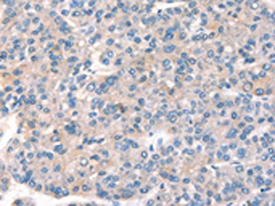 KCNB1 Antibody