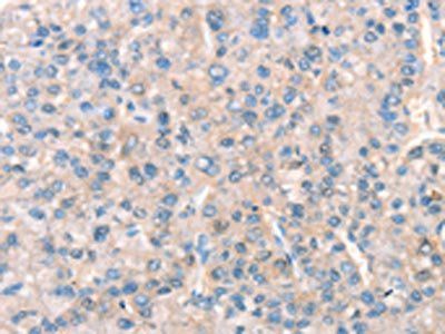 KCNB1 Antibody