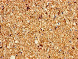 KCNC1 Antibody