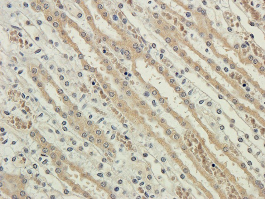 KCND3 Rabbit Polyclonal Antibody