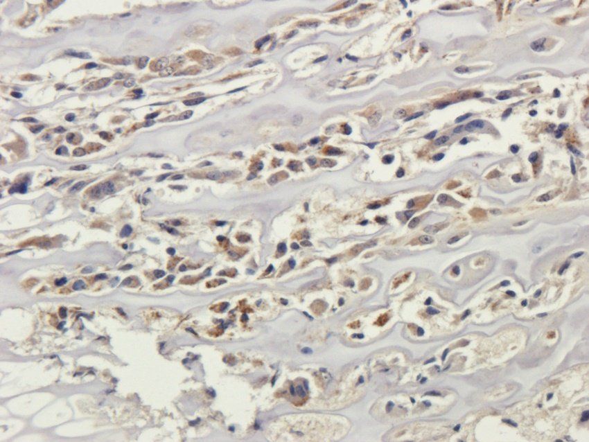 KCND3 Rabbit Polyclonal Antibody