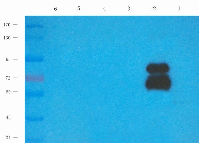KCND3 Rabbit Polyclonal Antibody