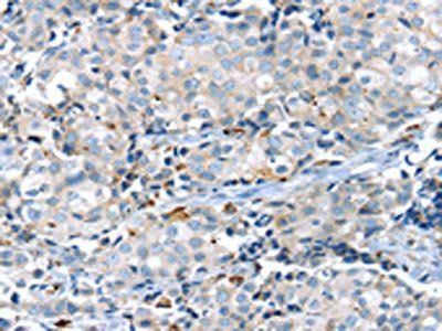 KCNG3 Antibody