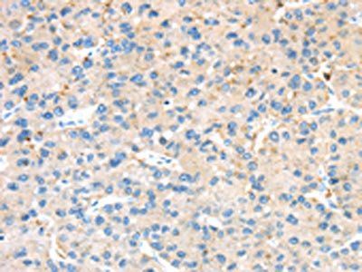 KCNG3 Antibody