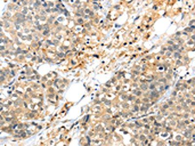 KCNG3 Antibody