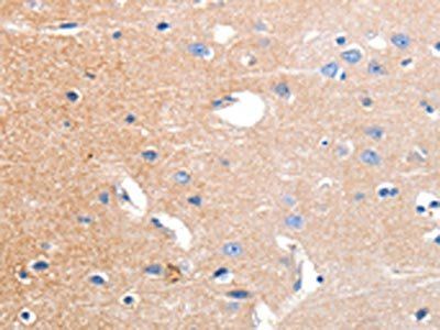 KCNH3 Antibody