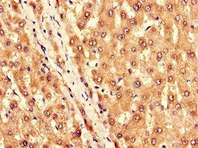 KCNJ11 Antibody