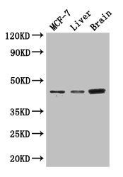 KCNJ11 Antibody