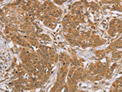 KCNJ15 Antibody