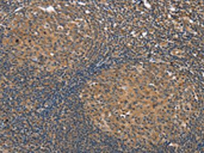 KCNJ15 Antibody