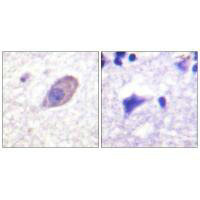 KCNJ16 Antibody