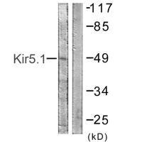 KCNJ16 Antibody