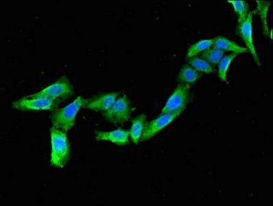 KCNJ3 Antibody