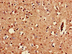 KCNJ3 Antibody
