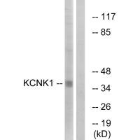 KCNK1 Antibody