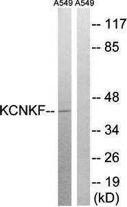 KCNK15 Antibody