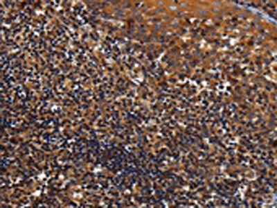 KCNK17 Antibody