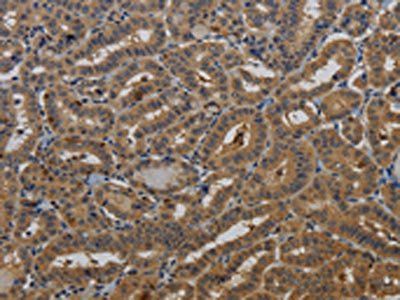 KCNK17 Antibody