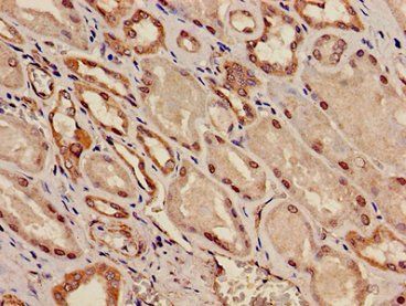 KCNK1 Antibody