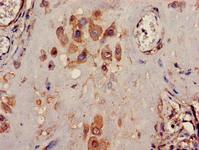 KCNK1 Antibody