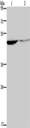 KCNK9 Antibody