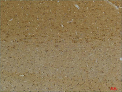 KCNK9 Antibody