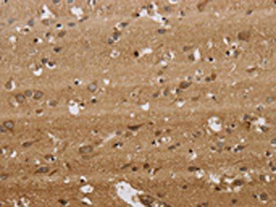 KCNMB2 Antibody