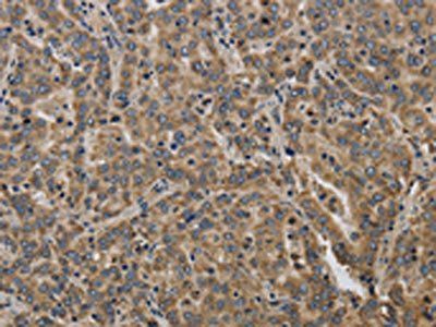 KCNMB2 Antibody