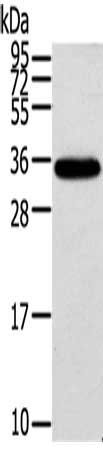 KCNMB3 Antibody