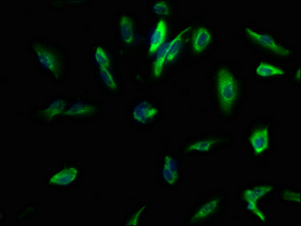KCNMB3 Antibody
