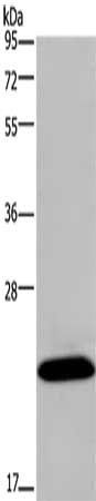 KCNMB4 Antibody