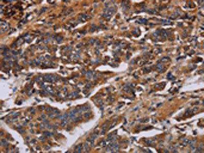 KCNQ1 Antibody
