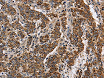KCNQ4 Antibody