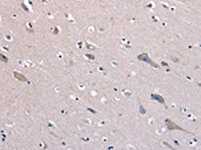 KCNQ5 Antibody
