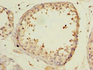 KCTD4 Antibody