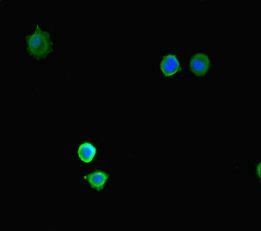KDM4A Antibody