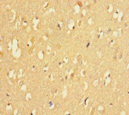 KDM4A Antibody
