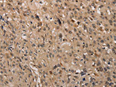 KDM4A Antibody