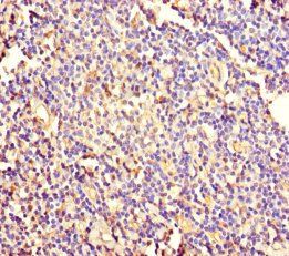 KRT4 Antibody