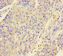 KRT4 Antibody