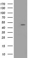 ketohexokinase Antibody