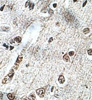 KIAA0317 Rabbit Polyclonal Antibody