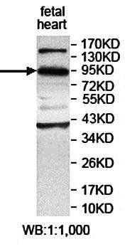 KIAA0317 Rabbit Polyclonal Antibody