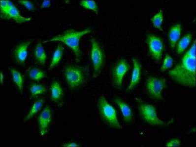 KIAA0319 Antibody