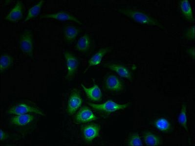 KIAA0319L Antibody