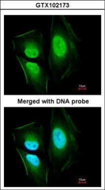 KIAA0494 Rabbit Polyclonal Antibody