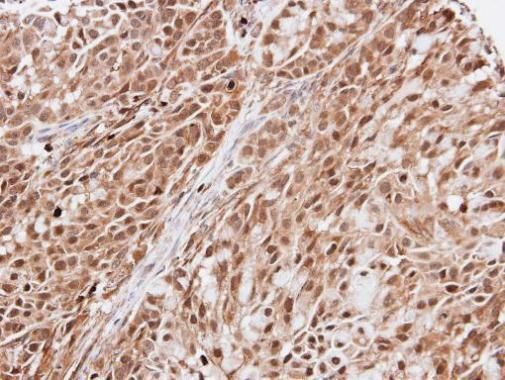 KIAA0494 Rabbit Polyclonal Antibody